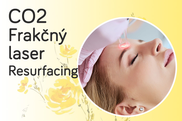 CO2 Frakn laser - Resurfacing