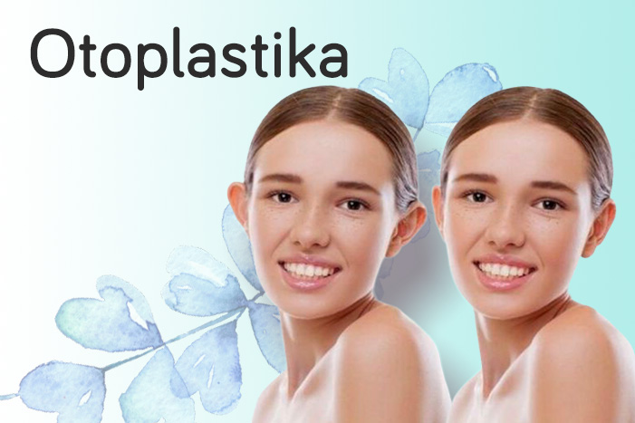 otoplastika