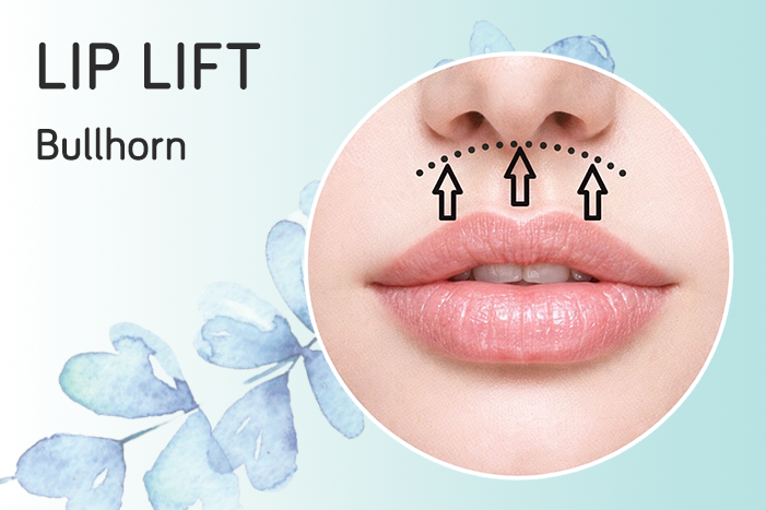 LipLift